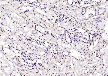 pSRF antibody