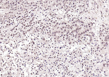 pSRF antibody