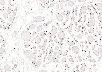 pSRF antibody