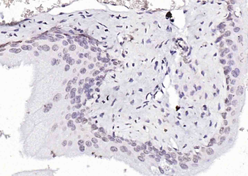 pSRF antibody