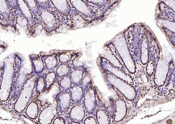 pSRF antibody