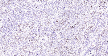 Ki67 antibody