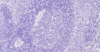 Ki67 antibody