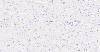 Ki67 antibody