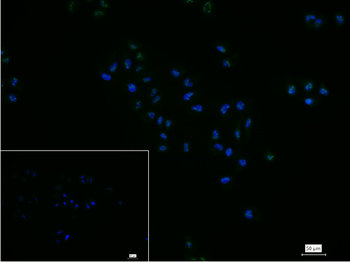 Ki67 antibody