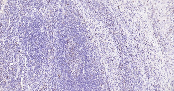 Ki67 antibody