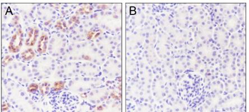 IKB Alpha (phospho-Ser32/Ser36) antibody