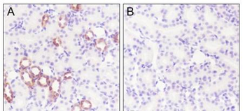 IKB Alpha (phospho-Ser32/Ser36) antibody