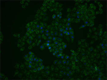 SQSTM1/p62 antibody