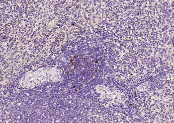 SQSTM1/p62 antibody