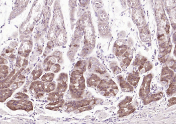 SQSTM1/p62 antibody