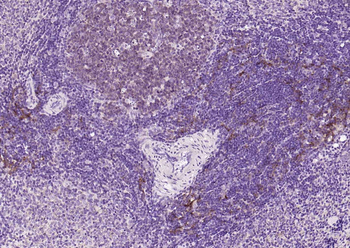 SQSTM1/p62 antibody