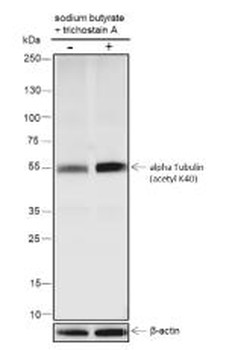 Alpha Tubulin (Acetyl-Lys40) antibody