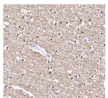 Alpha Tubulin (Acetyl-Lys40) antibody