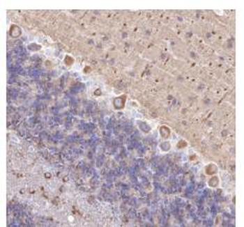 Alpha Tubulin (Acetyl-Lys40) antibody