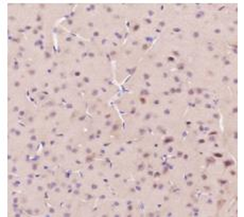 AKT1/AKT2/AKT3 antibody