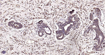 PTP1B antibody