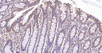 PTP1B antibody