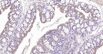 PTP1B antibody