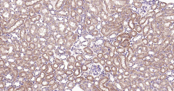 PTP1B antibody