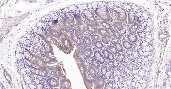 PTP1B antibody