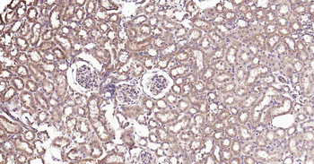 PTP1B antibody