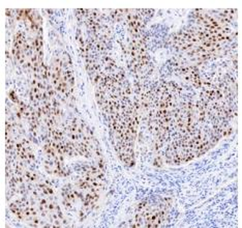 p21 antibody