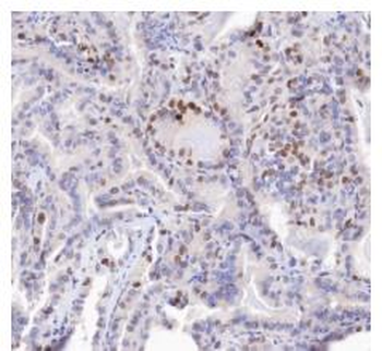 p21 antibody