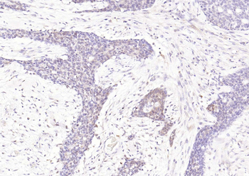 STAT1 antibody