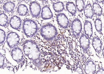 STAT1 antibody