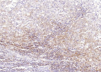 STAT1 antibody