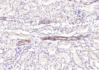 STAT1 antibody