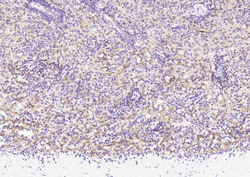 STAT1 antibody