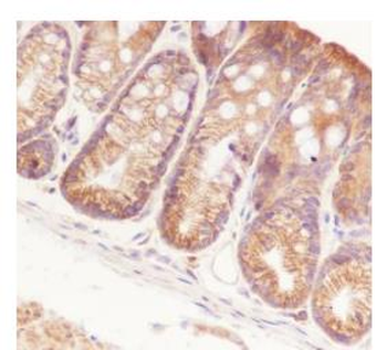 NFKB2 antibody