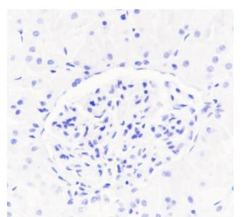 PAX5 antibody