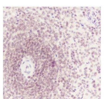 ATF1 antibody