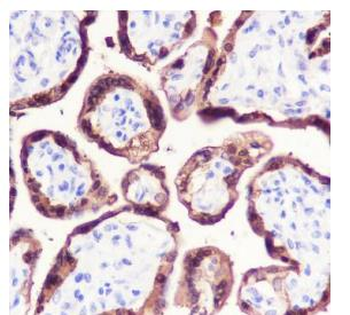 HSD17B1 antibody