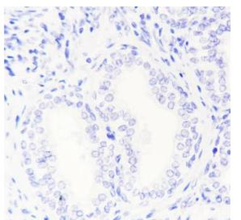 HSD17B1 antibody