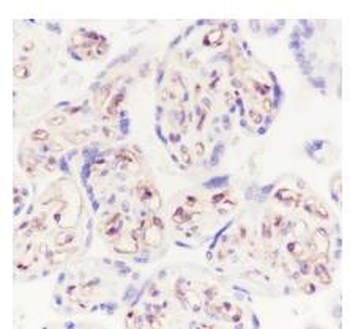 Moesin antibody