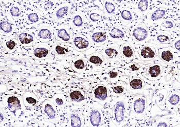 Lysozyme antibody