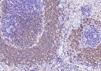 CD20 antibody