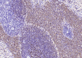 CD20 antibody