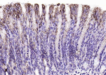 Claudin 18.2 antibody