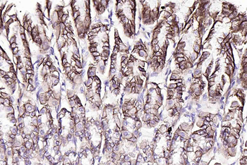 Claudin 18.2 antibody