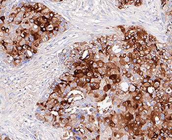 GCDGP15 antibody