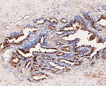 GCDGP15 antibody