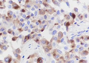 GCDGP15 antibody