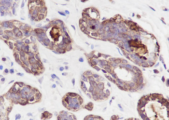 GCDGP15 antibody