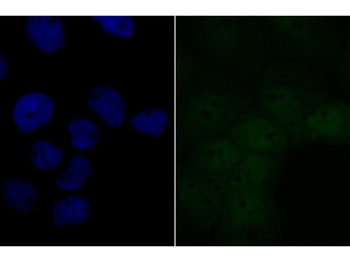 BRD2 antibody