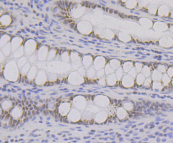 BRD2 antibody